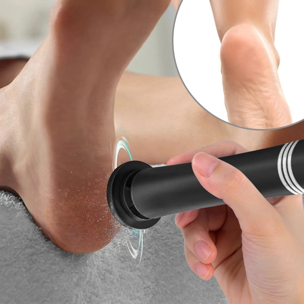 Callus Remover Electric Pedicure Foot Calus Remover Tool Professional Aluminum Callus Remover for Dead Skin and Calluses